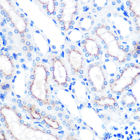 [KO Validated] LAMP2 Rabbit mAb