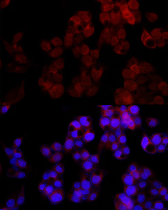 NUDT5 Rabbit mAb