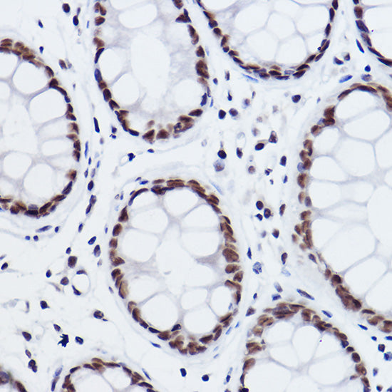 MED4 Rabbit mAb