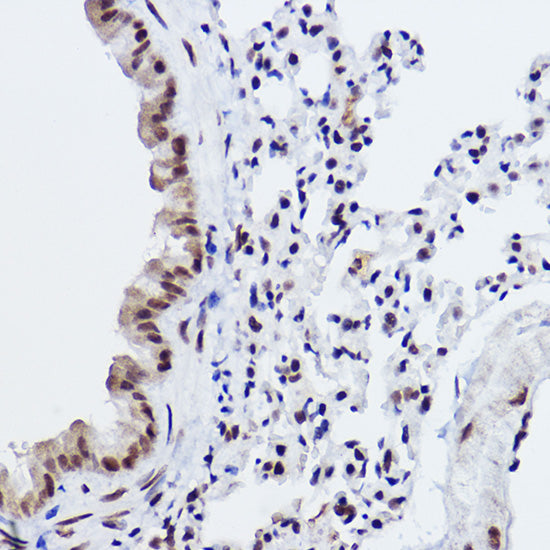 MED4 Rabbit mAb