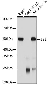 SSB Rabbit pAb