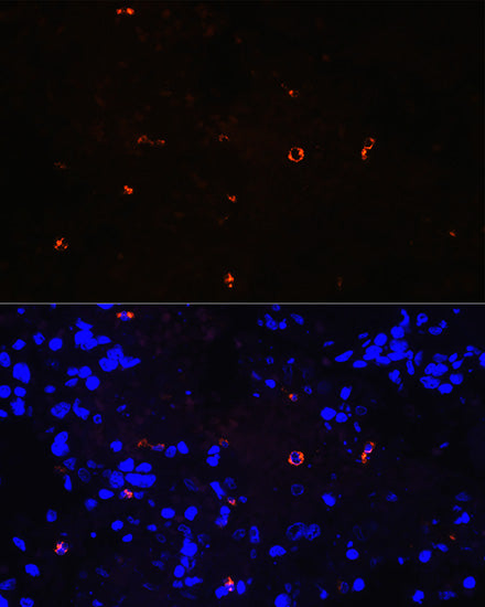 Lysozyme (LYZ) Rabbit mAb