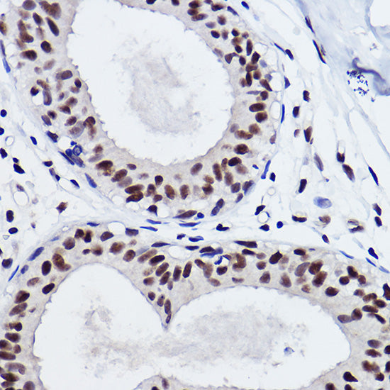 SNRPA1 Rabbit mAb
