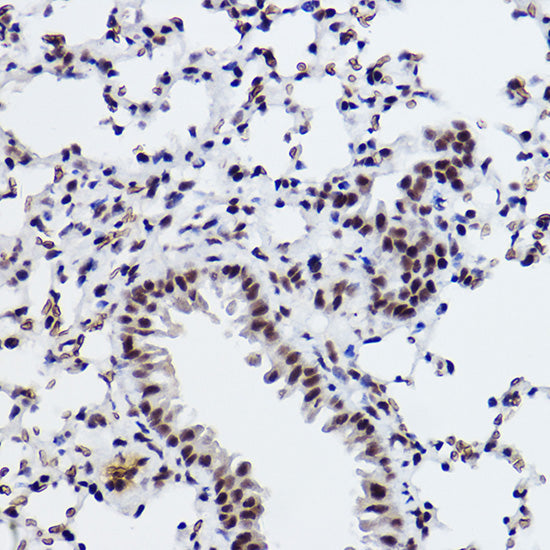 SNRPA1 Rabbit mAb
