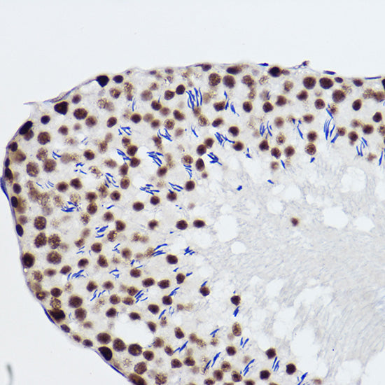 SNRPA1 Rabbit mAb