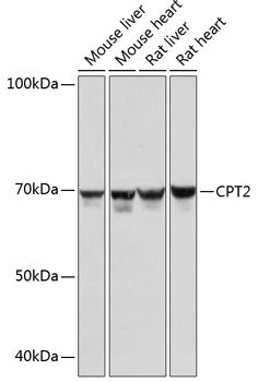 CPT2 Rabbit mAb