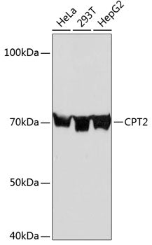 CPT2 Rabbit mAb