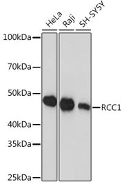 RCC1 Rabbit mAb