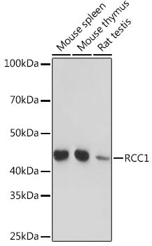 RCC1 Rabbit mAb
