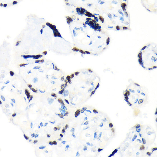 RCC1 Rabbit mAb