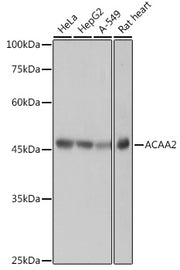 ACAA2 Rabbit mAb