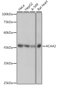 ACAA2 Rabbit mAb
