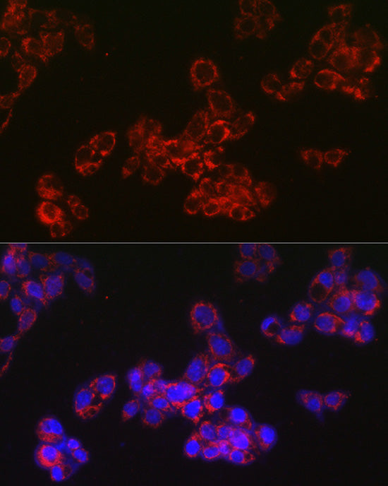 ACAA2 Rabbit mAb