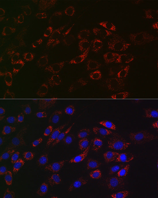 ACAA2 Rabbit mAb