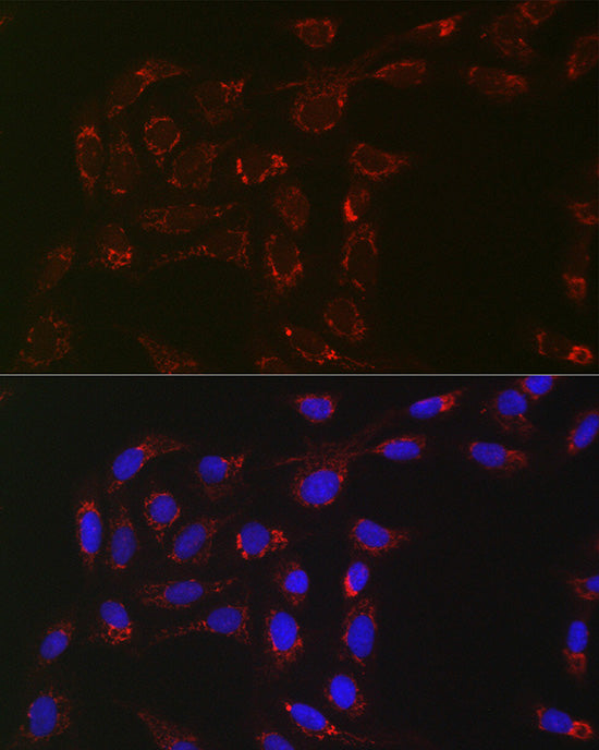 ACAA2 Rabbit mAb