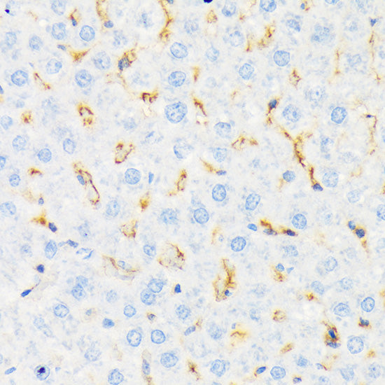 CSK Rabbit mAb