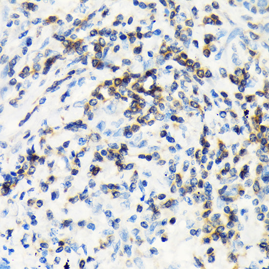 CSK Rabbit mAb