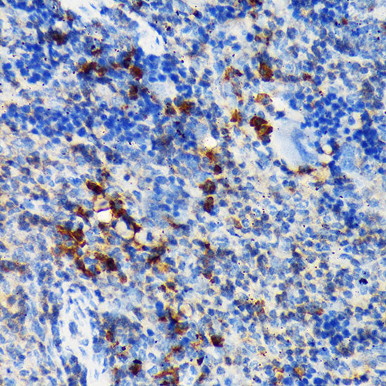 CSK Rabbit mAb