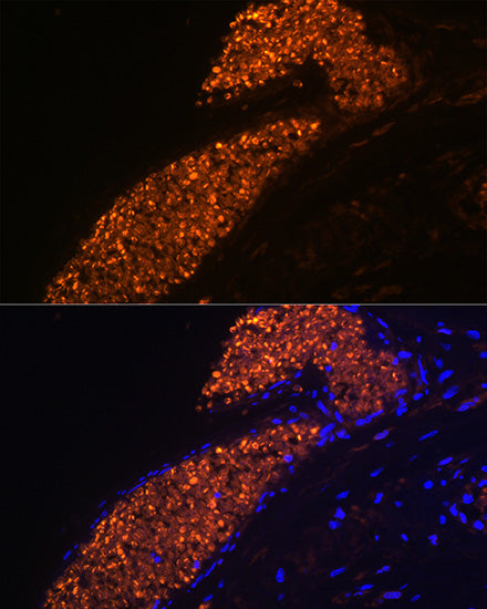 HBG1/2 Rabbit mAb