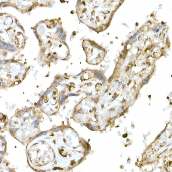 NRF2 Rabbit pAb
