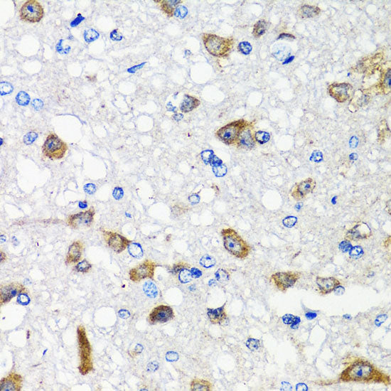 ACVR1C Rabbit pAb