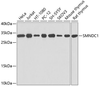 SMNDC1 Rabbit pAb