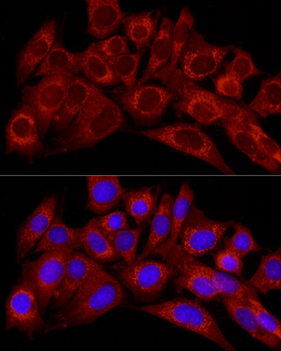Endothelin 1 Rabbit pAb