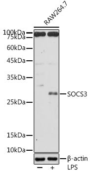 SOCS3 Rabbit pAb