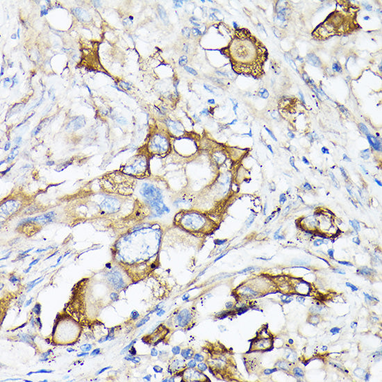 MMP7 Rabbit pAb