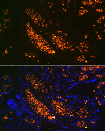 HBG1/2 Rabbit mAb