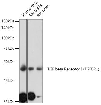 TGF beta Receptor I (TGFBR1) Rabbit pAb