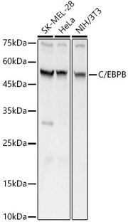 C/EBPB Rabbit pAb