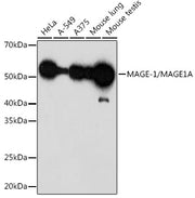 MAGE-1/MAGE1A Rabbit mAb