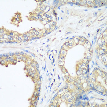 CBL Rabbit pAb