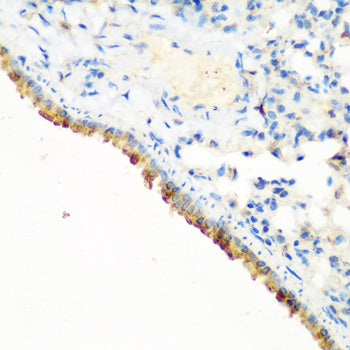 CBL Rabbit pAb