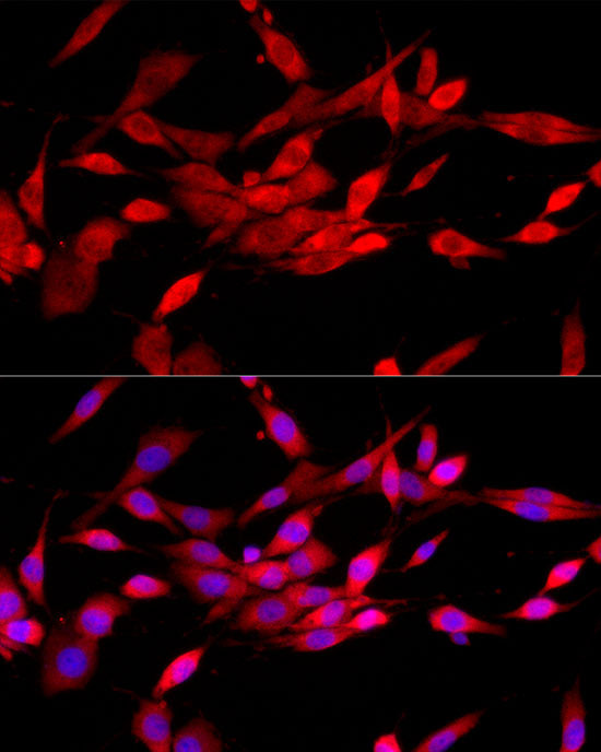 CBL Rabbit pAb