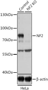 [KD Validated] NF2 Rabbit pAb