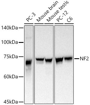 [KD Validated] NF2 Rabbit pAb