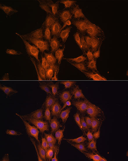 [KD Validated] NF2 Rabbit pAb