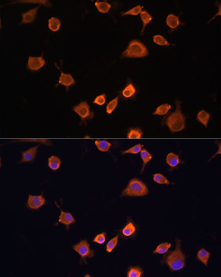 [KD Validated] NF2 Rabbit pAb