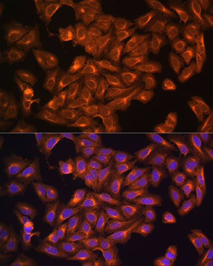 [KD Validated] NF2 Rabbit pAb