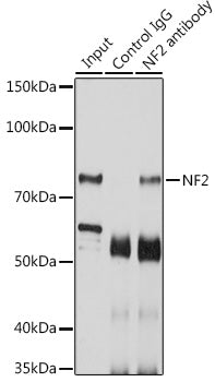 [KD Validated] NF2 Rabbit pAb