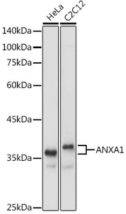 ANXA1 Rabbit pAb