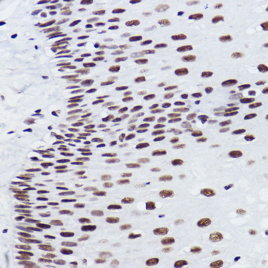 BRMS1 Rabbit mAb