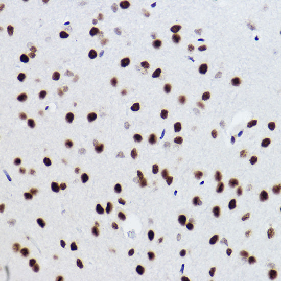 BRMS1 Rabbit mAb