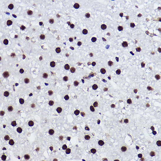 BRMS1 Rabbit mAb
