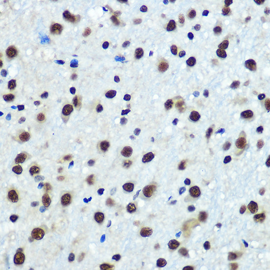 hnRNP K Rabbit mAb
