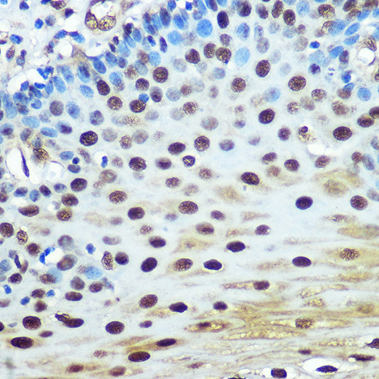 hnRNP K Rabbit mAb