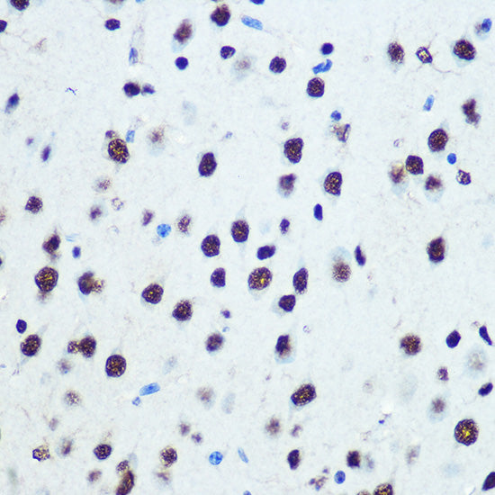 hnRNP K Rabbit mAb