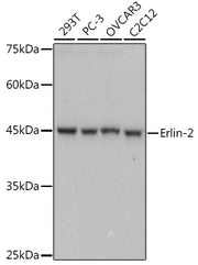 Erlin-2 Rabbit mAb